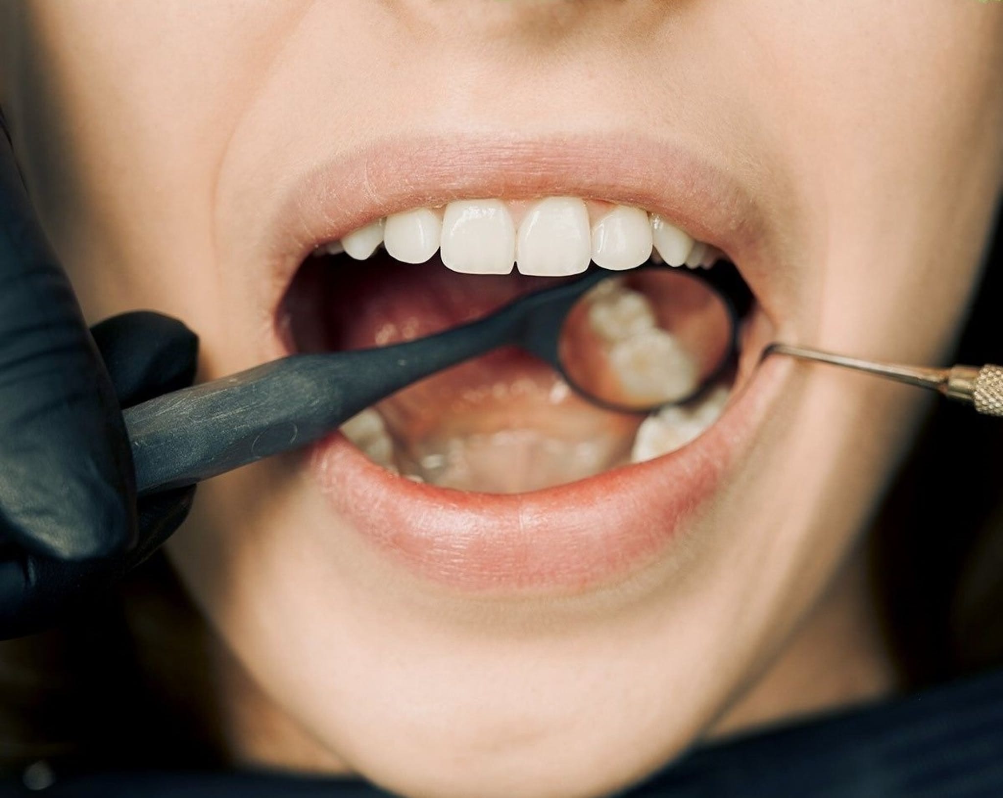 Close-up Photo of an IV Fluid Hanging on Pole. Ivy Lane Dentistry offers moderate intravenous sedation for dentistry procedures in San Antonio, TX. 